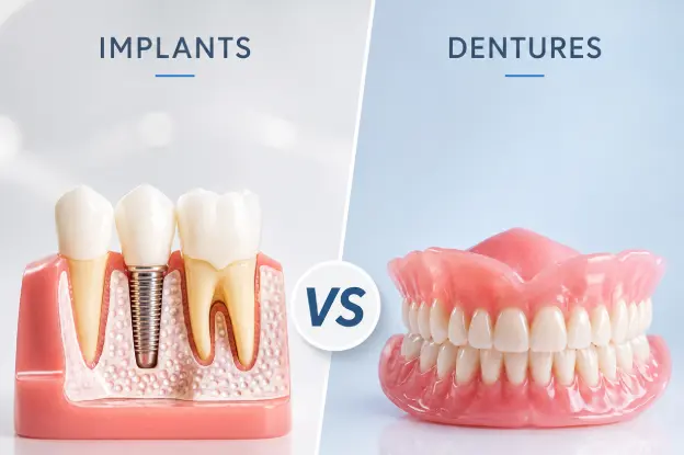 Helpful dental information about dental implants in Kenilworth