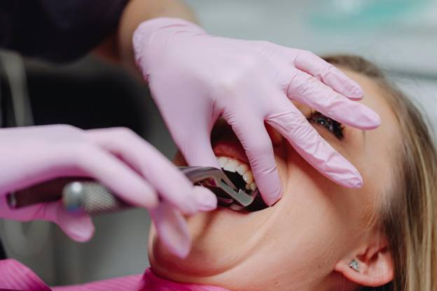 Top 6 Reasons for Tooth Extraction in Kenilworth