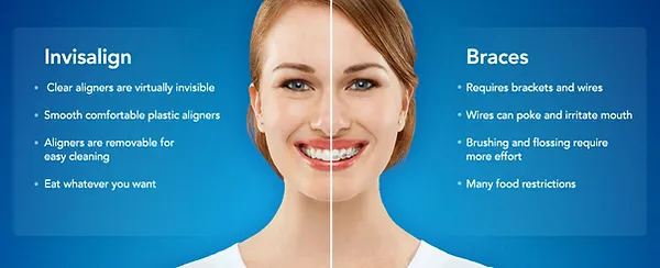 Invisalign Kenilworth